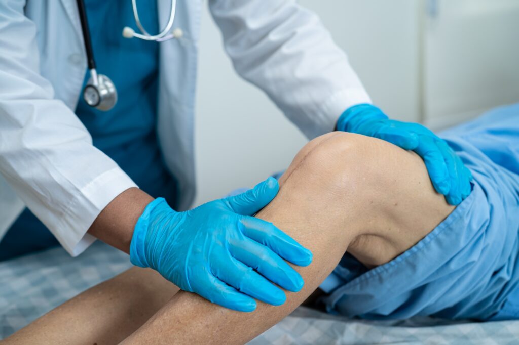 Asian senior patient show her scars surgical total knee joint replacement