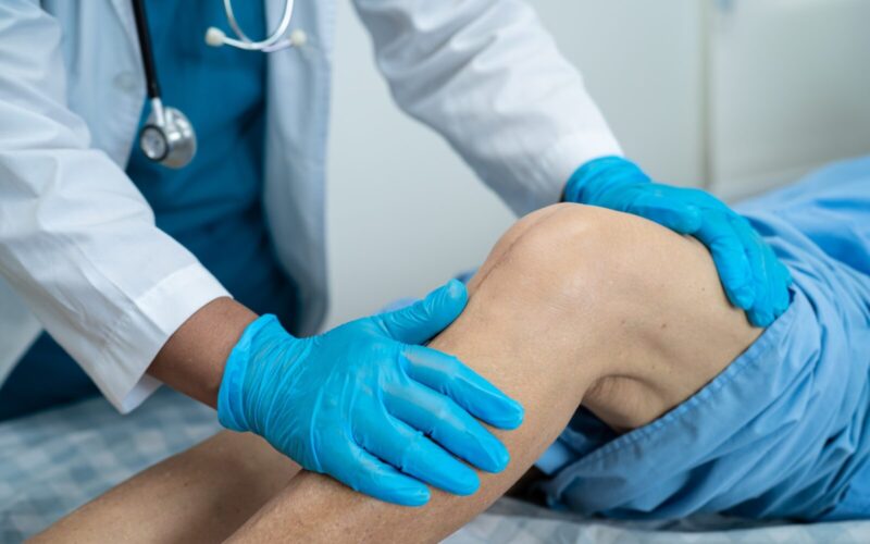 Asian senior patient show her scars surgical total knee joint replacement